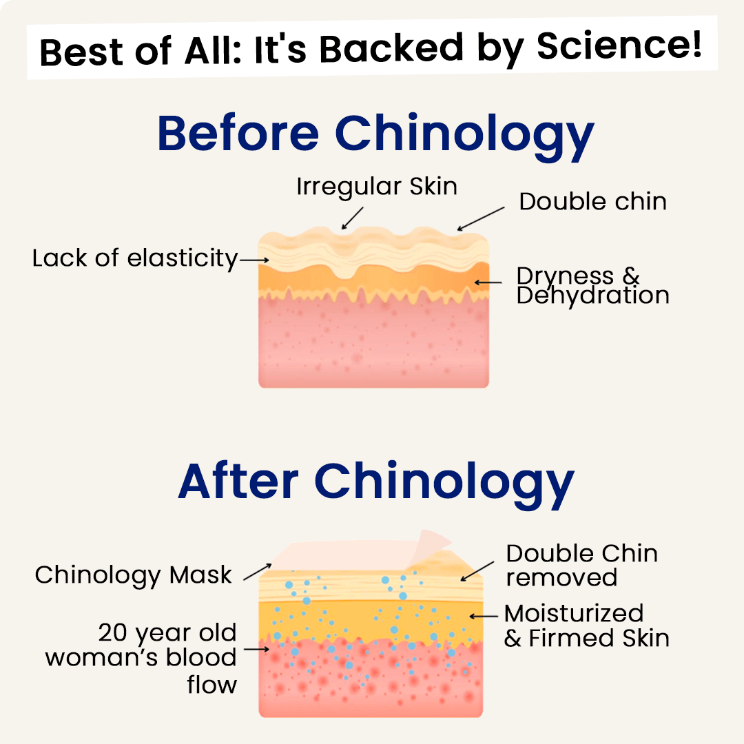 The Chinology™ Lift  - Exclusive Christmas Sale